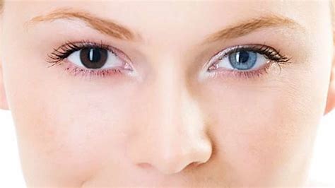 odd eyes human|What Is Heterochromia and Why Do Some People Have Different .